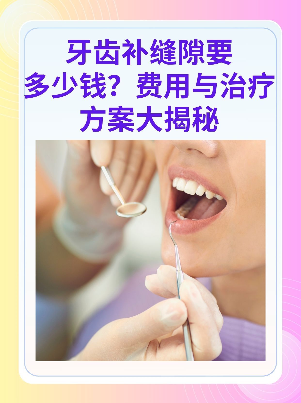 淄博补牙医保可以报销吗(补牙医保可以报销吗 哪些可以报销呢)